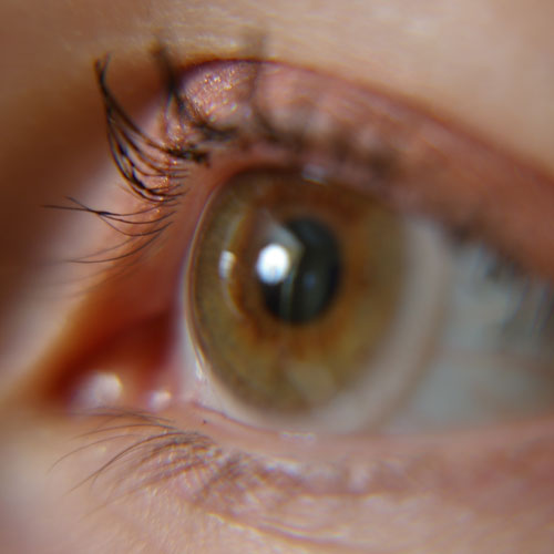 Les lentilles et la vue